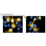 Diagram - SPiDER-ßGal - Senescence Detection Probe (A57211) - Antibodies.com