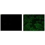 Diagram - Sulfur Biology™ SSP4 - Sulfane Sulfur Probe (A57215) - Antibodies.com