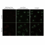 Diagram - Mitophagy Detection Kit - Fluorescent (A57288) - Antibodies.com