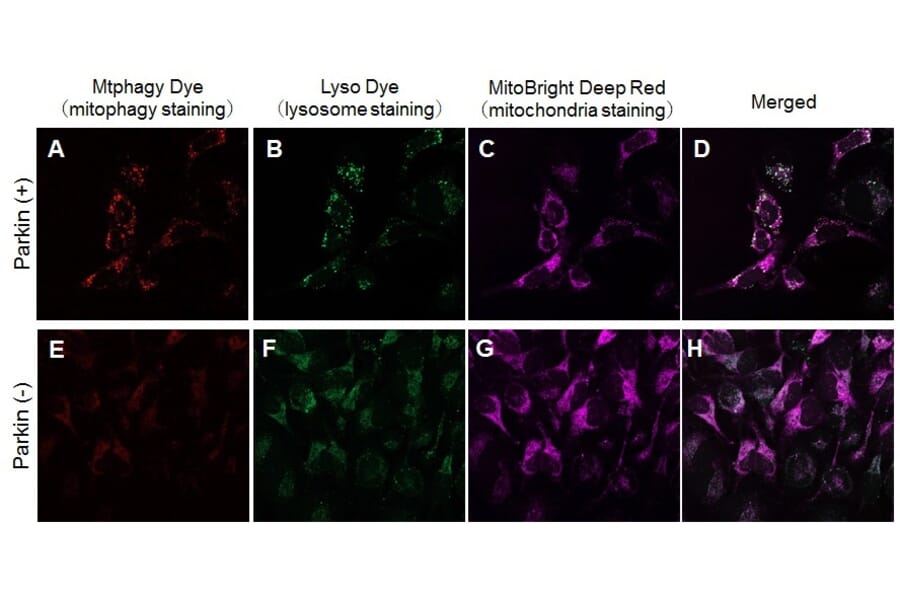 Diagram - Mitophagy Detection Kit - Fluorescent (A57288) - Antibodies.com