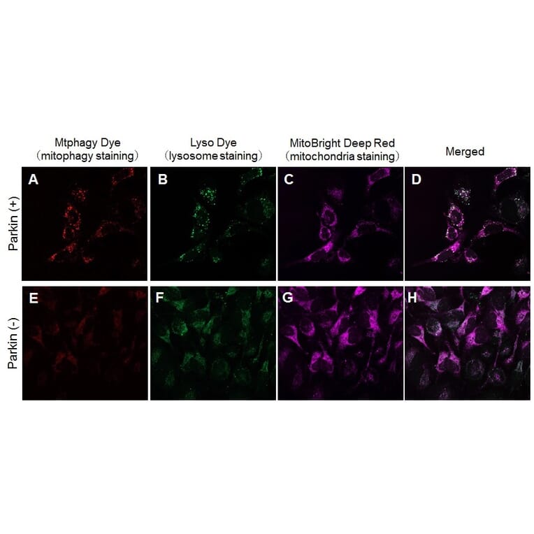Diagram - Mitophagy Detection Kit - Fluorescent (A57288) - Antibodies.com