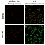 Diagram - Mitophagy Detection Kit - Fluorescent (A57288) - Antibodies.com