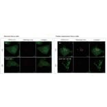 Diagram - Mitophagy Detection Kit - Fluorescent (A57288) - Antibodies.com