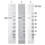 Diagram - Peroxidase Labeling Kit - Amine Reactive (A57319) - Antibodies.com