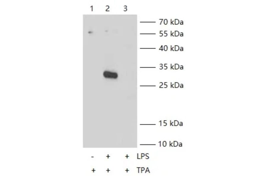 IL-1 beta KO Validation - Human IL-1 beta ELISA Kit (A74447) - Antibodies.com