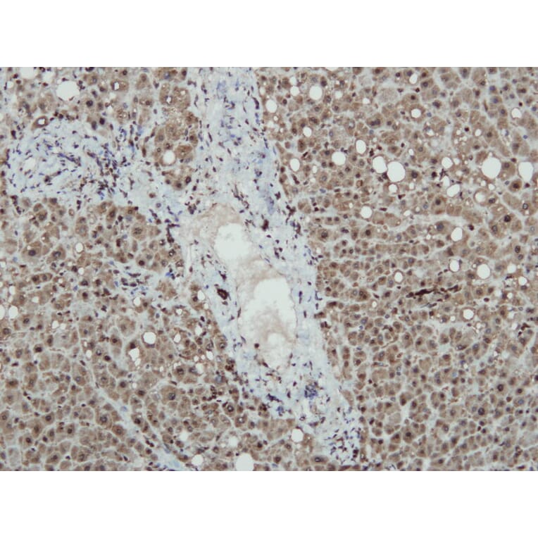 Immunohistochemistry - Anti-iNOS Antibody - Antibodies.com (A8188)