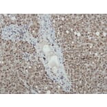 Immunohistochemistry - Anti-iNOS Antibody - Antibodies.com (A8188)