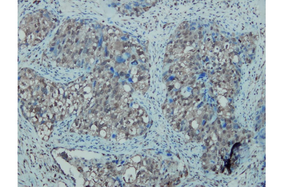 Immunohistochemistry - Anti-iNOS Antibody - Antibodies.com (A8188)