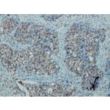 Immunohistochemistry - Anti-iNOS Antibody - Antibodies.com (A8188)