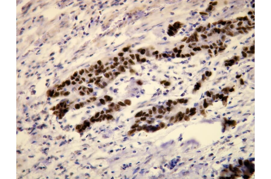 Immunohistochemistry - Anti-p53 Antibody - Antibodies.com (A8189)