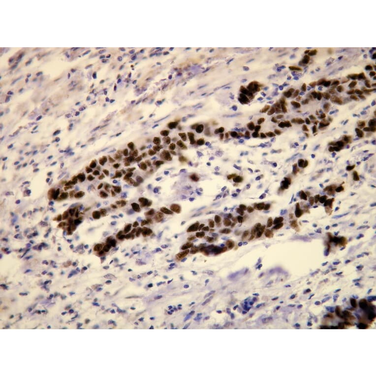 Immunohistochemistry - Anti-p53 Antibody - Antibodies.com (A8189)