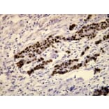 Immunohistochemistry - Anti-p53 Antibody - Antibodies.com (A8189)
