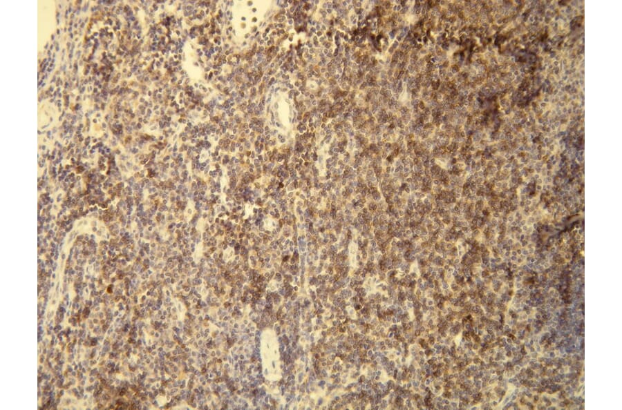 Immunohistochemistry - Anti-CD5 Antibody - Antibodies.com (A8190)