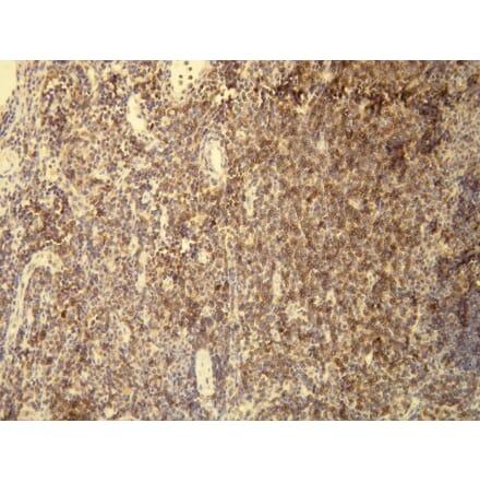 Immunohistochemistry - Anti-CD5 Antibody - Antibodies.com (A8190)