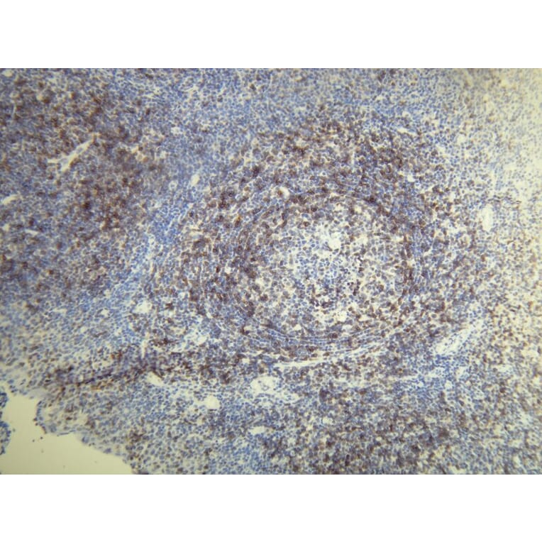 Immunohistochemistry - Anti-CD5 Antibody - Antibodies.com (A8190)