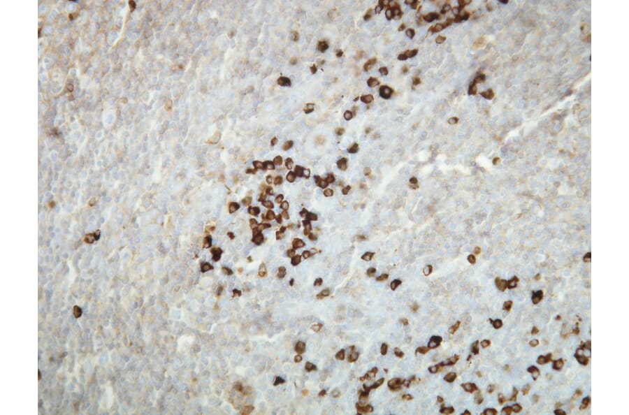 Immunohistochemistry - Anti-Human Kappa Light Chain Antibody - Antibodies.com (A8191)