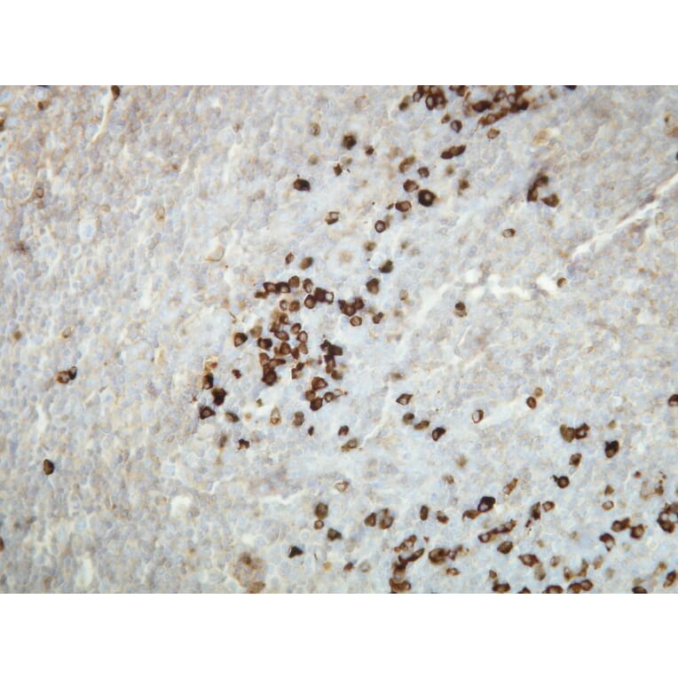 Immunohistochemistry - Anti-Human Kappa Light Chain Antibody - Antibodies.com (A8191)