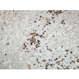 Immunohistochemistry - Anti-Human Kappa Light Chain Antibody - Antibodies.com (A8191)