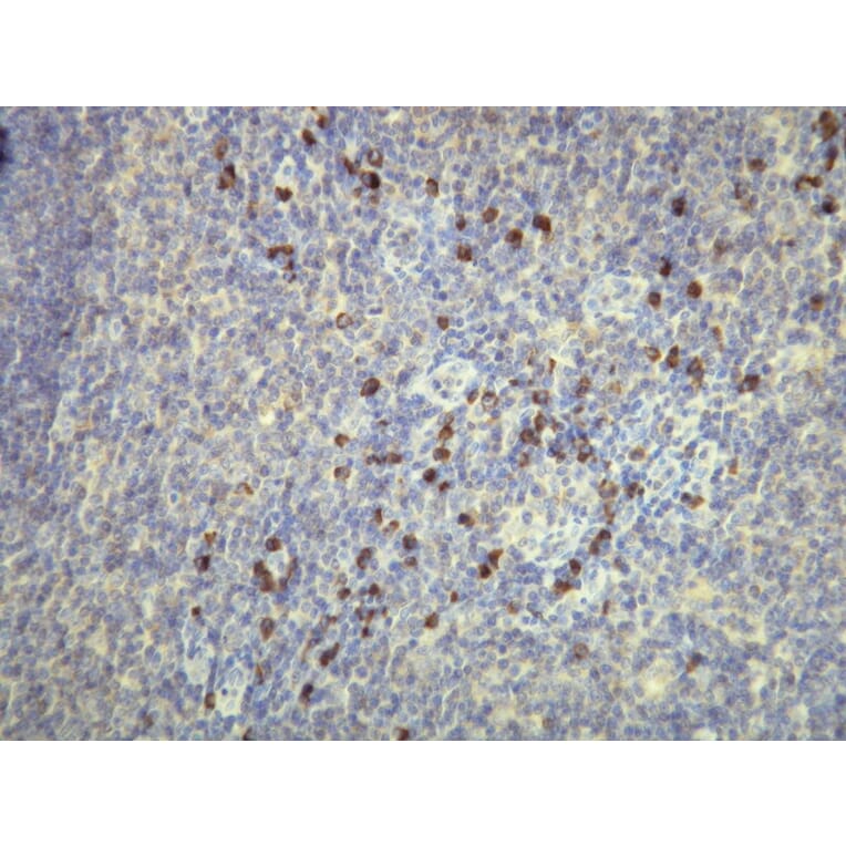 Immunohistochemistry - Anti-Human Kappa Light Chain Antibody - Antibodies.com (A8191)