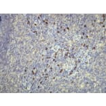 Immunohistochemistry - Anti-Human Kappa Light Chain Antibody - Antibodies.com (A8191)