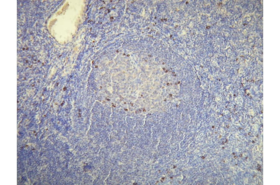 Immunohistochemistry - Anti-Human Kappa Light Chain Antibody - Antibodies.com (A8192)
