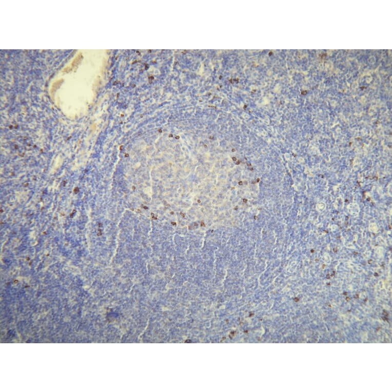 Immunohistochemistry - Anti-Human Kappa Light Chain Antibody - Antibodies.com (A8192)