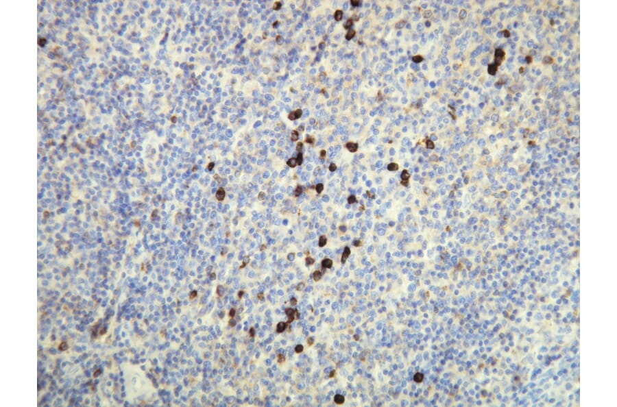 Immunohistochemistry - Anti-Human Lambda Light Chain Antibody - Antibodies.com (A8193)
