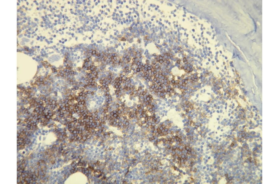 Immunohistochemistry - Anti-CD20 Antibody - Antibodies.com (A8194)