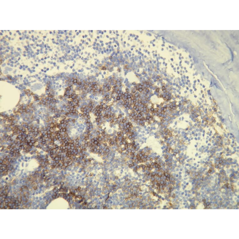 Immunohistochemistry - Anti-CD20 Antibody - Antibodies.com (A8194)