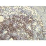 Immunohistochemistry - Anti-CD20 Antibody - Antibodies.com (A8194)