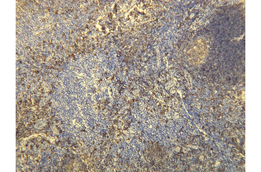 Immunohistochemistry - Anti-CD20 Antibody - Antibodies.com (A8194)