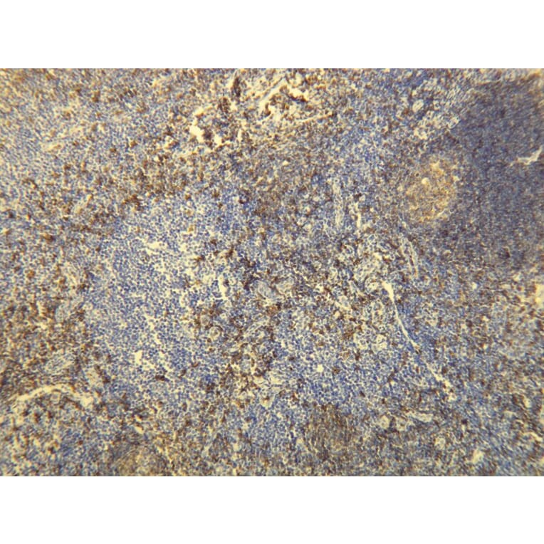 Immunohistochemistry - Anti-CD20 Antibody - Antibodies.com (A8194)