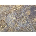 Immunohistochemistry - Anti-CD20 Antibody - Antibodies.com (A8194)