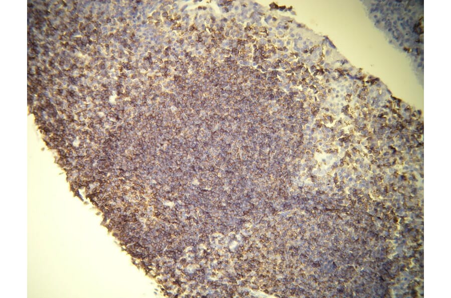Immunohistochemistry - Anti-CD45 Antibody - Antibodies.com (A8195)