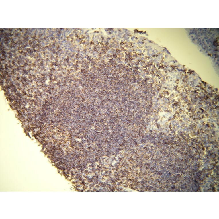 Immunohistochemistry - Anti-CD45 Antibody - Antibodies.com (A8195)