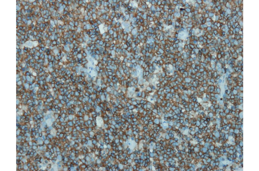 Immunohistochemistry - Anti-CD45 Antibody - Antibodies.com (A8195)