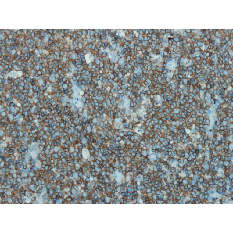 Immunohistochemistry - Anti-CD45 Antibody - Antibodies.com (A8195)