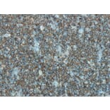 Immunohistochemistry - Anti-CD45 Antibody - Antibodies.com (A8195)