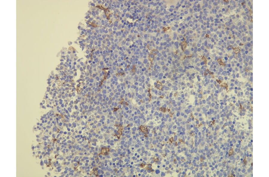 Immunohistochemistry - Anti-CD163 Antibody - Antibodies.com (A8196)