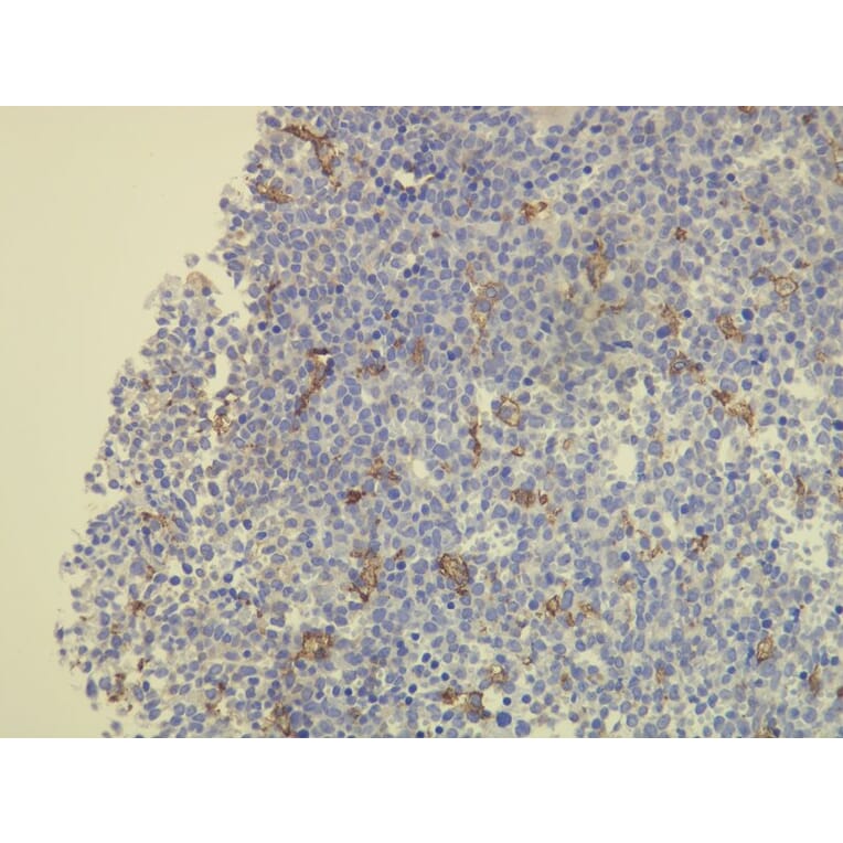 Immunohistochemistry - Anti-CD163 Antibody - Antibodies.com (A8196)