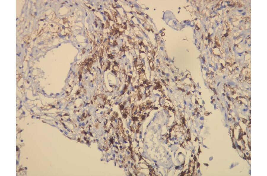 Immunohistochemistry - Anti-CD163 Antibody - Antibodies.com (A8196)