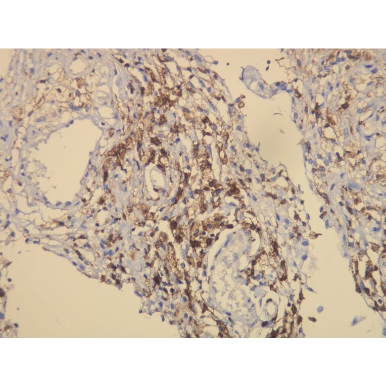 Immunohistochemistry - Anti-CD163 Antibody - Antibodies.com (A8196)