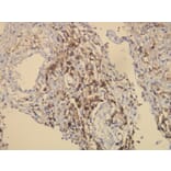 Immunohistochemistry - Anti-CD163 Antibody - Antibodies.com (A8196)