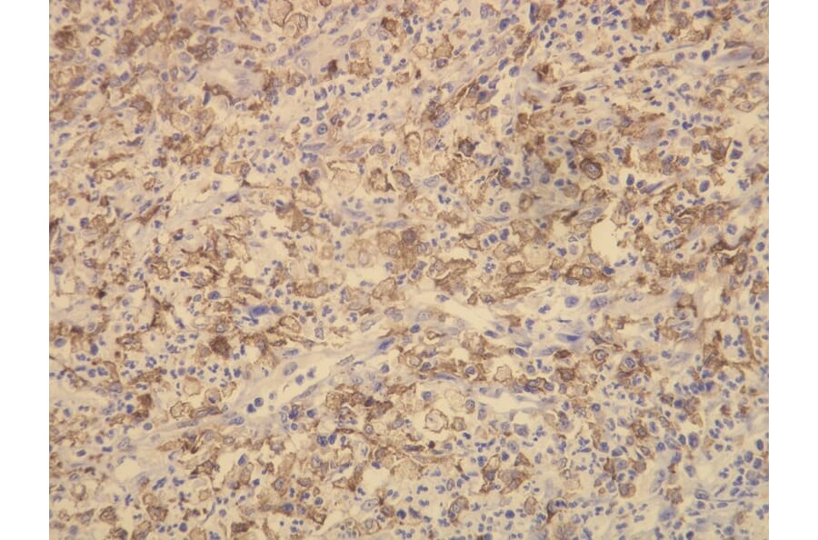 Immunohistochemistry - Anti-CD163 Antibody - Antibodies.com (A8196)