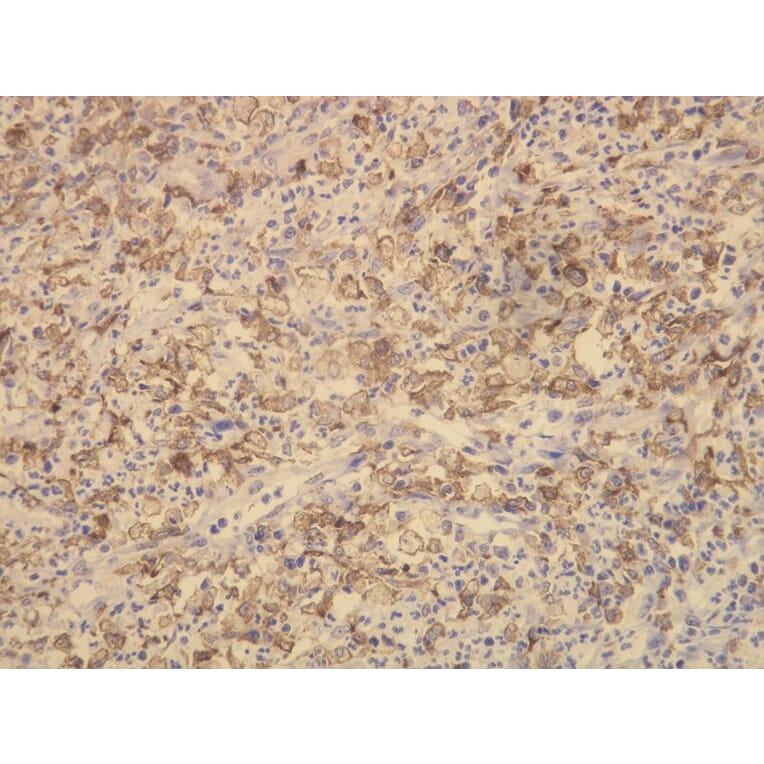 Immunohistochemistry - Anti-CD163 Antibody - Antibodies.com (A8196)