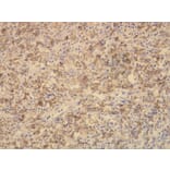 Immunohistochemistry - Anti-CD163 Antibody - Antibodies.com (A8196)