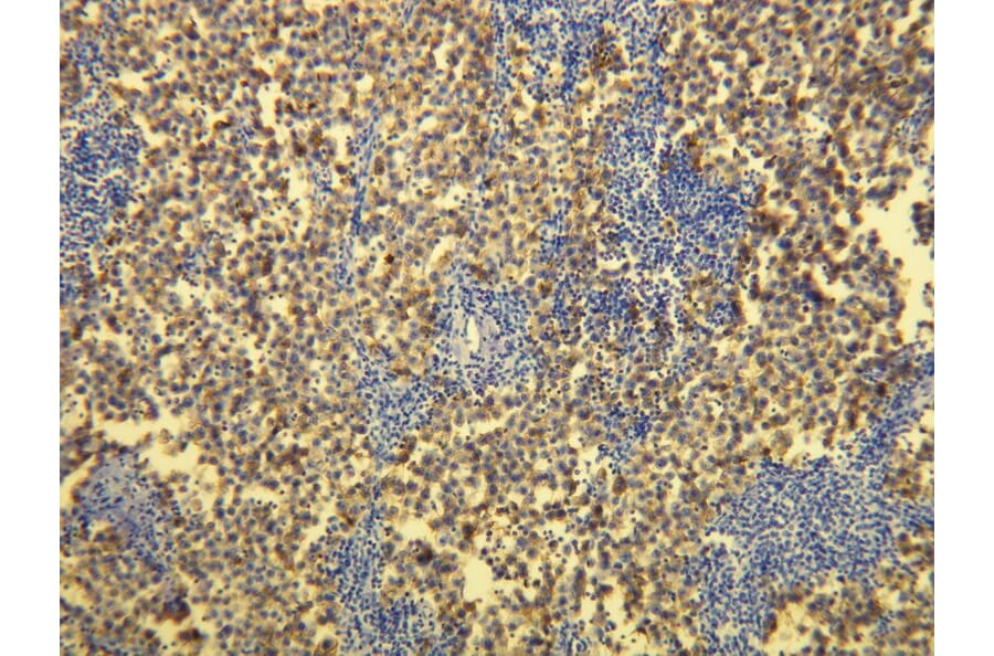 Immunohistochemistry - Anti-PLAP Antibody - Antibodies.com (A8197)