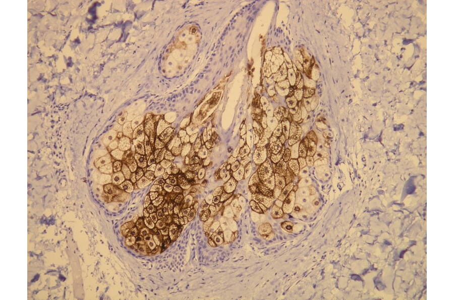 Immunohistochemistry - Anti-EMA Antibody - Antibodies.com (A8198)