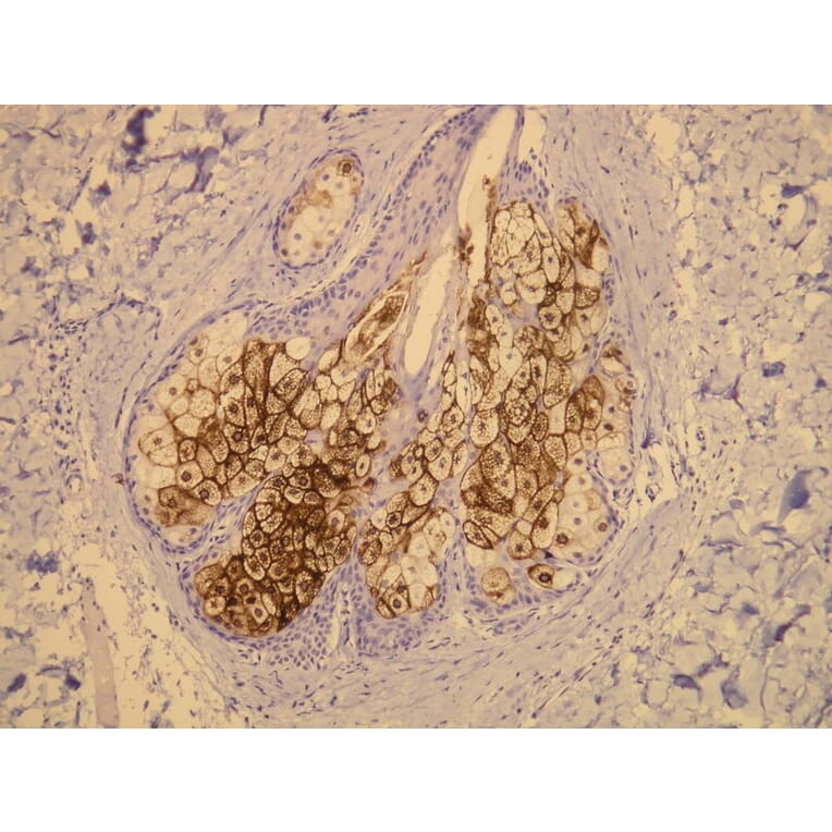 Immunohistochemistry - Anti-EMA Antibody - Antibodies.com (A8198)