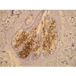 Immunohistochemistry - Anti-EMA Antibody - Antibodies.com (A8198)